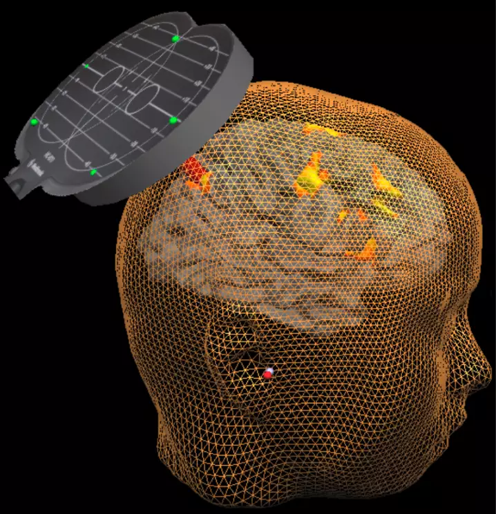 Bridging the gap between scientific research and clinical practice in the field of non-invasive brain stimulation (TMS and TES)