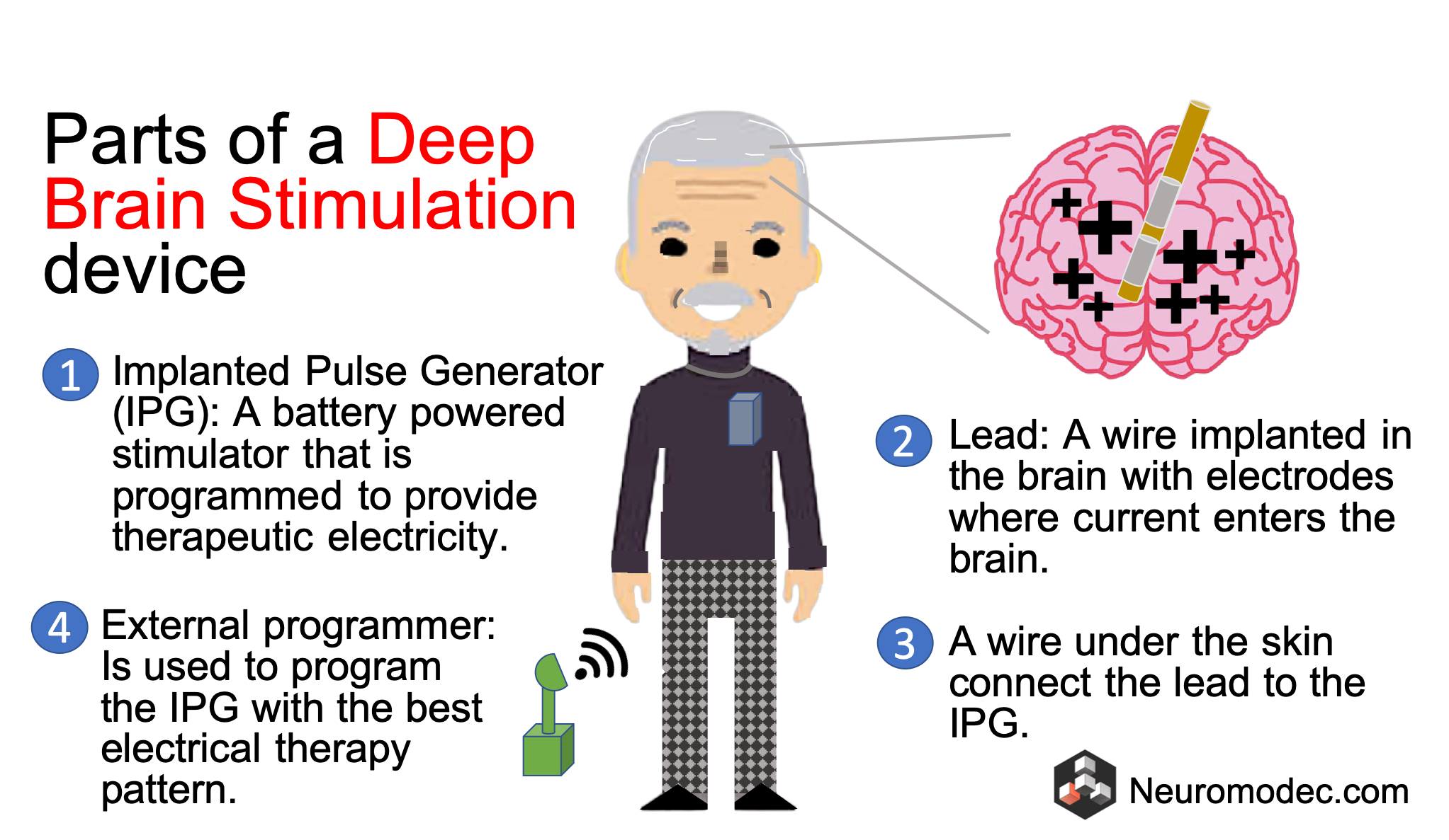Parts of a Deep Brain Stimulation Device