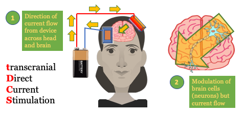 tDCS schematic showing a head model with electrodes and direction of current flow